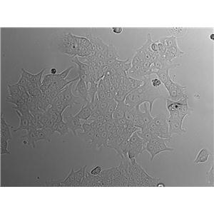 CAL-62 Epithelial Cell|人甲状腺癌传代细胞(有STR鉴定)