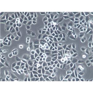Vero C1008 Epithelial Cell|非洲绿猴肾传代细胞(有STR鉴定)