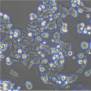 CAL-120 Epithelial Cell|人乳腺癌传代细胞(有STR鉴定)