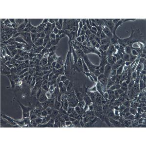 SNU-869 Epithelial Cell|人胆管癌传代细胞(有STR鉴定),SNU-869 Epithelial Cell