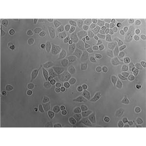 UM-UC-1 Epithelial Cell|人膀胱移行癌傳代細(xì)胞(有STR鑒定)