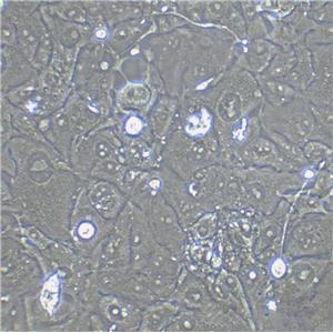 RT-112 Epithelial Cell|人膀胱癌传代细胞(有STR鉴定)