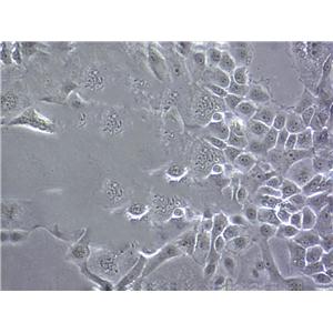 LA-N-6 Epithelial Cell|人神经母传代细胞(有STR鉴定)