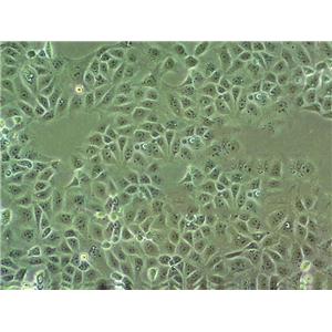 SW900 Epithelial Cell|人肺癌传代细胞(有STR鉴定)