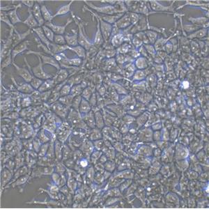 MDST8 Epithelial Cell|人结肠癌传代细胞(有STR鉴定)