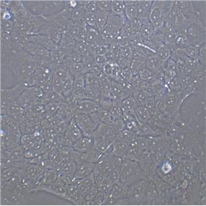 TE-12 Epithelial Cell|人食道癌肿瘤传代细胞(有STR鉴定)