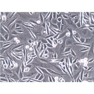 NUGC-2 Epithelial Cell|人低分化胃癌腺癌传代细胞(有STR鉴定)