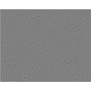 NCM460 Epithelial Cell|结直肠腺癌传代细胞(有STR鉴定)