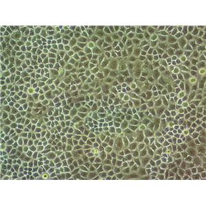 SNU-761 Epithelial Cell|人肝癌传代细胞(有STR鉴定),SNU-761 Epithelial Cell