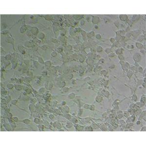 D407 Epithelial Cell|人视网膜色素上皮传代细胞(有STR鉴定)