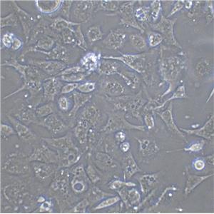 Tu 212 Epithelial Cell|人喉癌传代细胞(有STR鉴定)