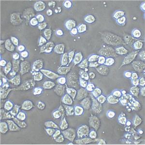 hs 68 Epithelial Cell|男性正常龟头传代细胞(有STR鉴定)