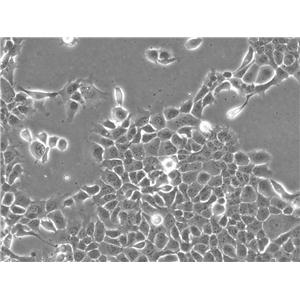 MNNG/HOS Cl #5 Epithelial Cell|人骨肉瘤传代细胞(有STR鉴定)