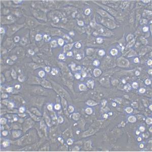 T-47D Epithelial Cell|人乳腺管癌传代细胞(有STR鉴定)