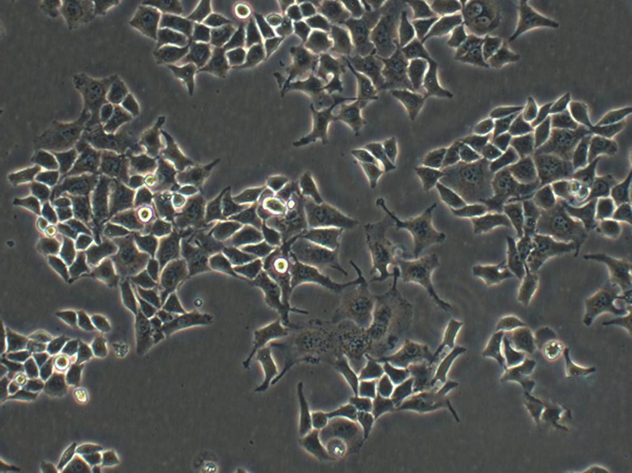 Nthy-ori 3-1 Epithelial Cell|人甲狀腺正常傳代細胞(有STR鑒定),Nthy-ori 3-1 Epithelial Cell