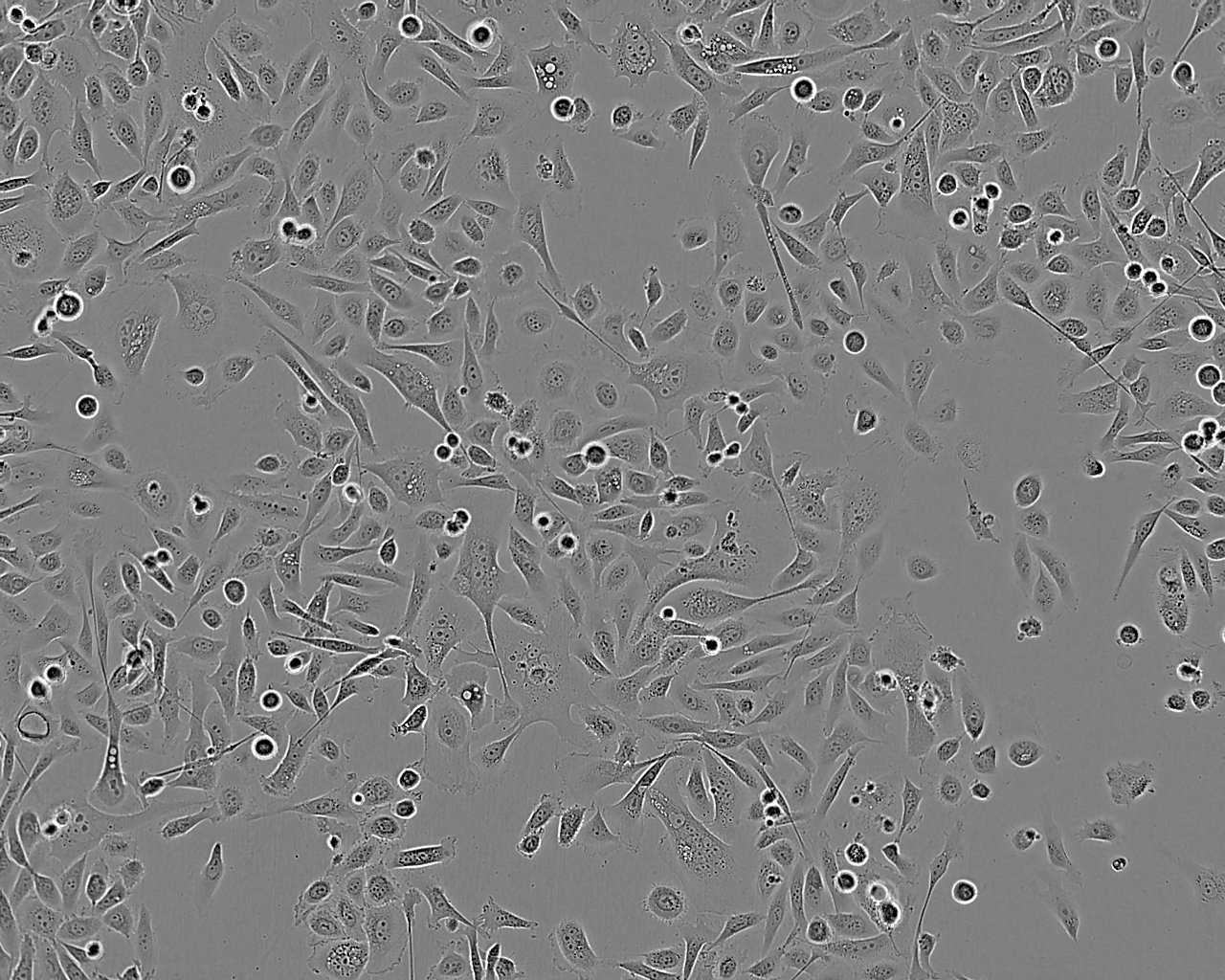 CCD-841CoN Epithelial Cell|人正常结肠上皮传代细胞(有STR鉴定),CCD-841CoN Epithelial Cell