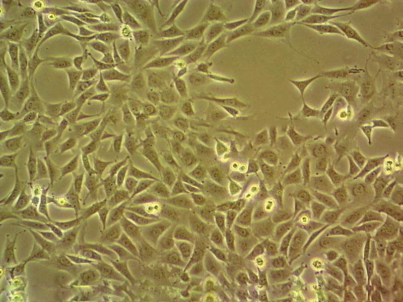 SCL-II Epithelial Cell|人皮膚鱗癌傳代細(xì)胞(有STR鑒定),SCL-II Epithelial Cell