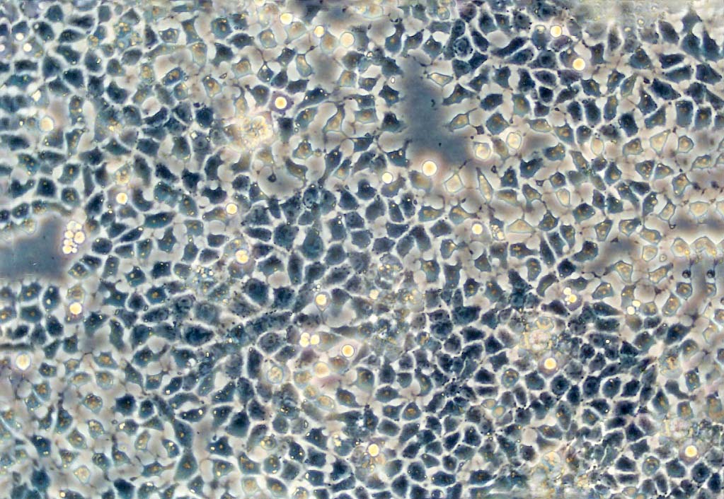 KPL-4 Epithelial Cell|人乳腺癌傳代細胞(有STR鑒定),KPL-4 Epithelial Cell