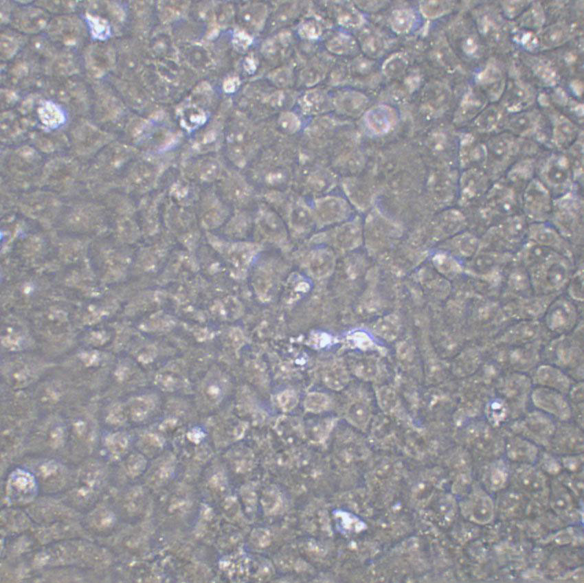 IOSE-80 Epithelial Cell|人正常卵巢上皮傳代細(xì)胞(有STR鑒定),IOSE-80 Epithelial Cell