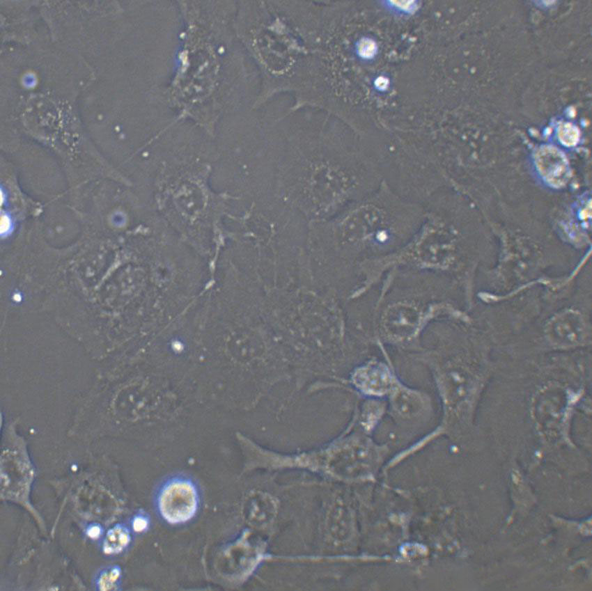 K7M2-WT Epithelial Cell|小鼠骨肉瘤成骨传代细胞(有STR鉴定),K7M2-WT Epithelial Cell