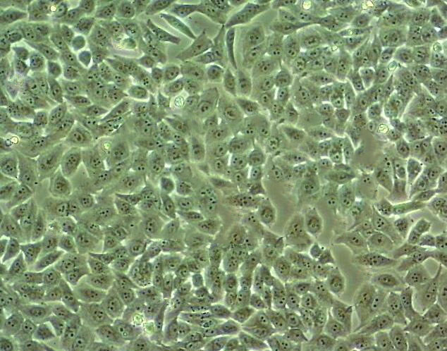 hEM15A Epithelial Cell|人永生化子宫内膜异位症患者在位内膜间质传代细胞(有STR鉴定),hEM15A Epithelial Cell