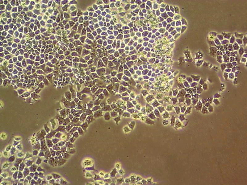 Ect1/E6E7 Epithelial Cell|人宫颈永生化鳞状传代细胞(有STR鉴定),Ect1/E6E7 Epithelial Cell