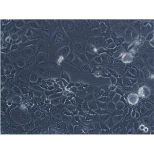 Vx2 Epithelial Cell|兔间变表皮鳞癌瘤传代细胞(有STR鉴定)