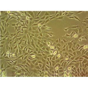 SCL-II Epithelial Cell|人皮肤鳞癌传代细胞(有STR鉴定)