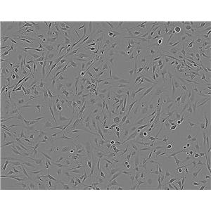 DiFi Epithelial Cell|人结直肠癌传代细胞(有STR鉴定)