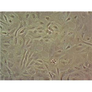 KYSE-180 Epithelial Cell|人食管鳞癌传代细胞(有STR鉴定)