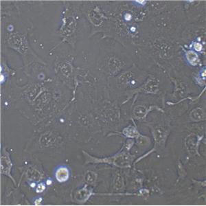 K7M2-WT Epithelial Cell|小鼠骨肉瘤成骨传代细胞(有STR鉴定)