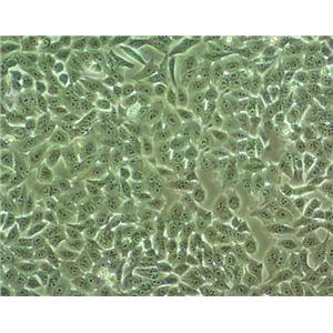 hEM15A Epithelial Cell|人永生化子宫内膜异位症患者在位内膜间质传代细胞(有STR鉴定),hEM15A Epithelial Cell