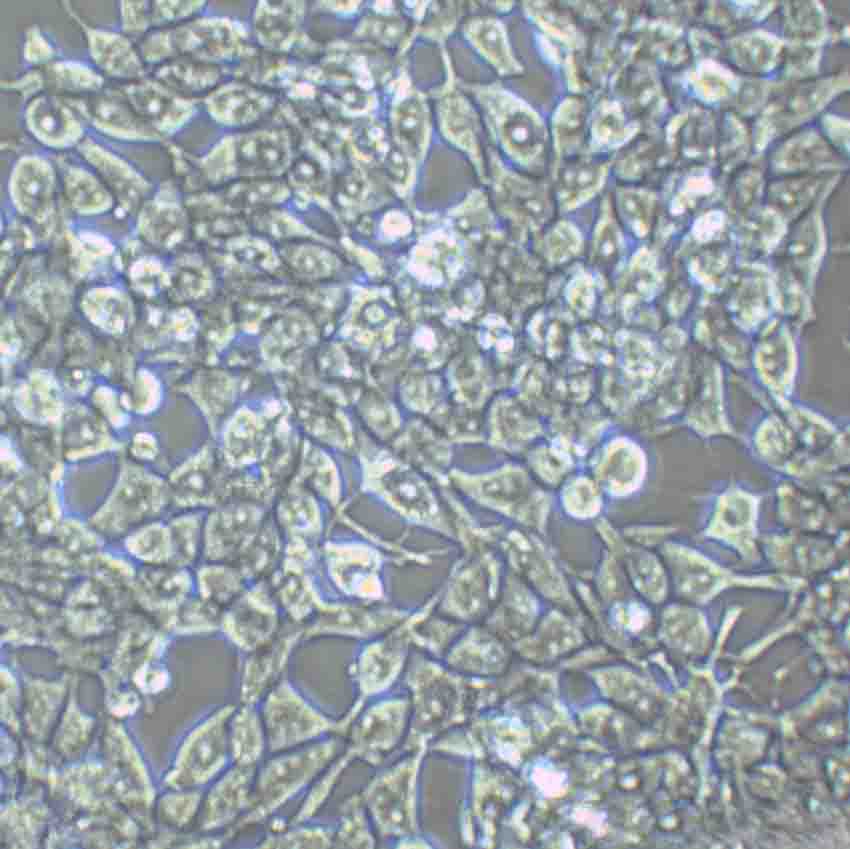 NCI-H508 Fresh Cells|人结肠直肠腺癌细胞(送STR鉴定图谱),NCI-H508 Fresh Cells