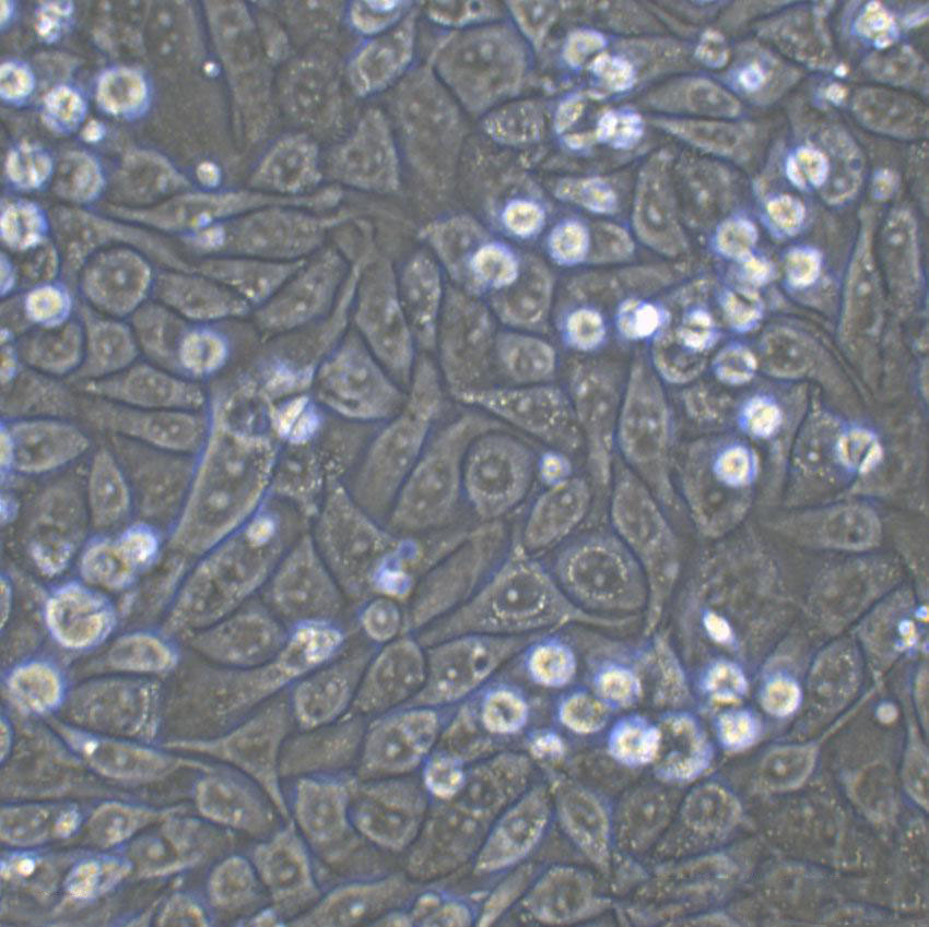 SW620 Fresh Cells|人结肠癌细胞(送STR鉴定图谱),SW620 Fresh Cells