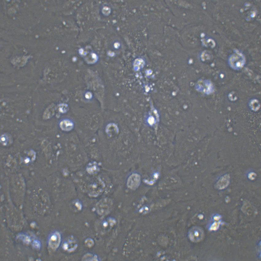 RKO Fresh Cells|人结肠癌细胞(送STR基因图谱),RKO Fresh Cells