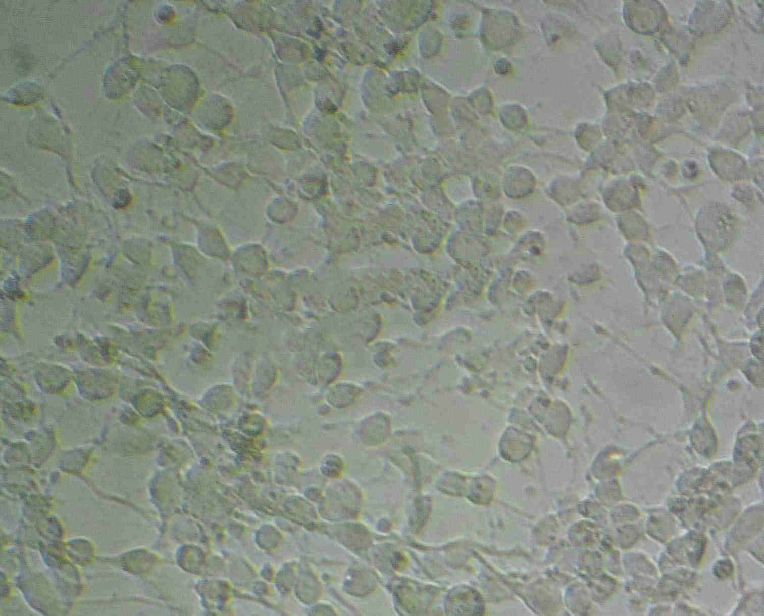 NCI-H1975 Fresh Cells|人肺腺癌细胞(送STR基因图谱),NCI-H1975 Fresh Cells