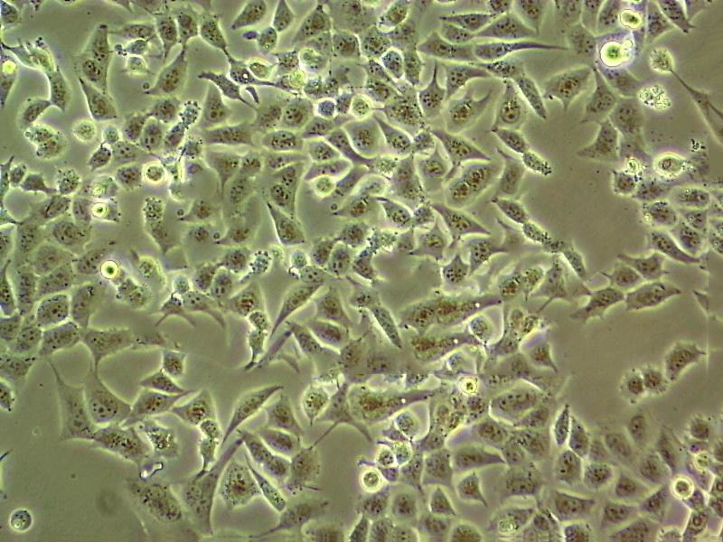 UM-UC-3 Fresh Cells|人膀胱移行癌细胞(送STR基因图谱),UM-UC-3 Fresh Cells