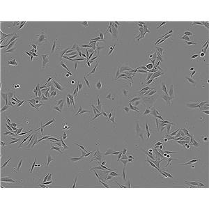 NCI-H1755 Fresh Cells|人肺癌细胞(送STR基因图谱)