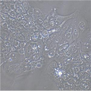 SMMC-7721 Fresh Cells|人肝癌细胞(送STR基因图谱)