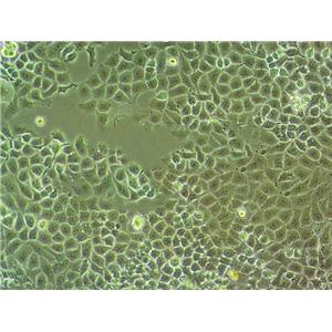 MDA-MB-415 Fresh Cells|人乳腺腺癌細(xì)胞(送STR基因圖譜),MDA-MB-415 Fresh Cells