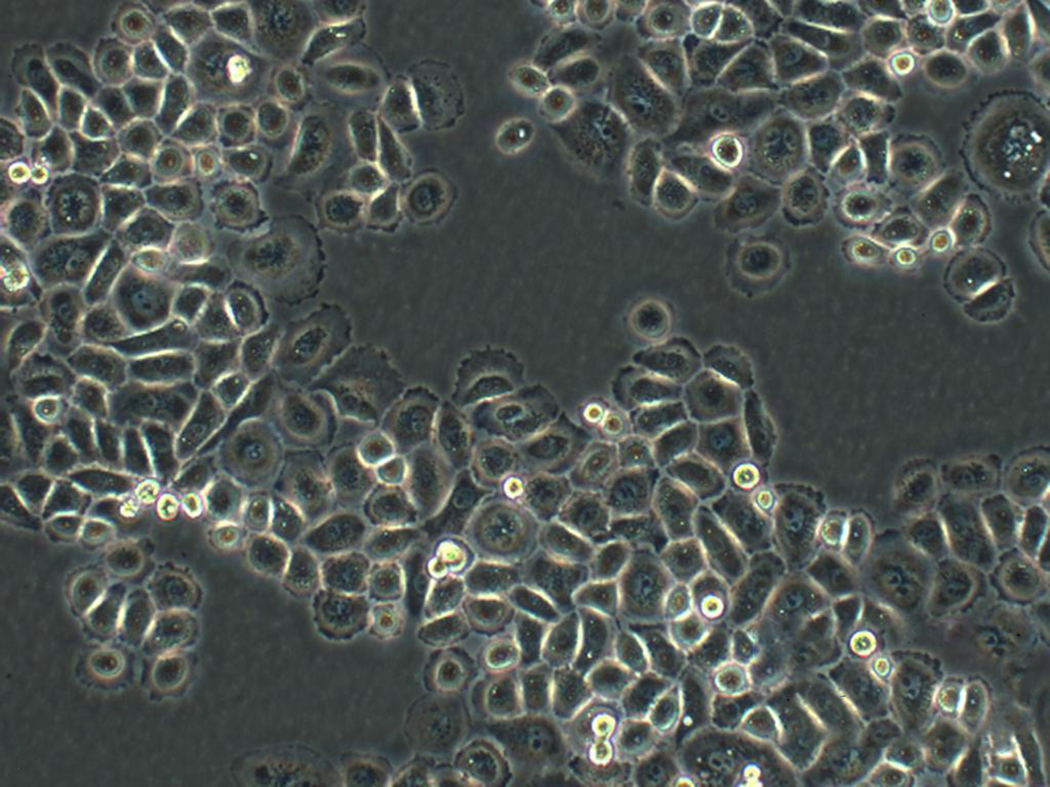 Caki-1 Fresh Cells|人肾透明细胞癌细胞(送STR基因图谱),Caki-1 Fresh Cells