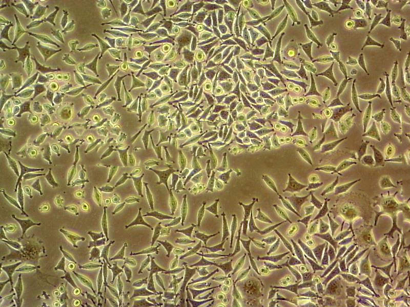 Ishikawa Fresh Cells|人子宫内膜癌细胞(送STR基因图谱),Ishikawa Fresh Cells