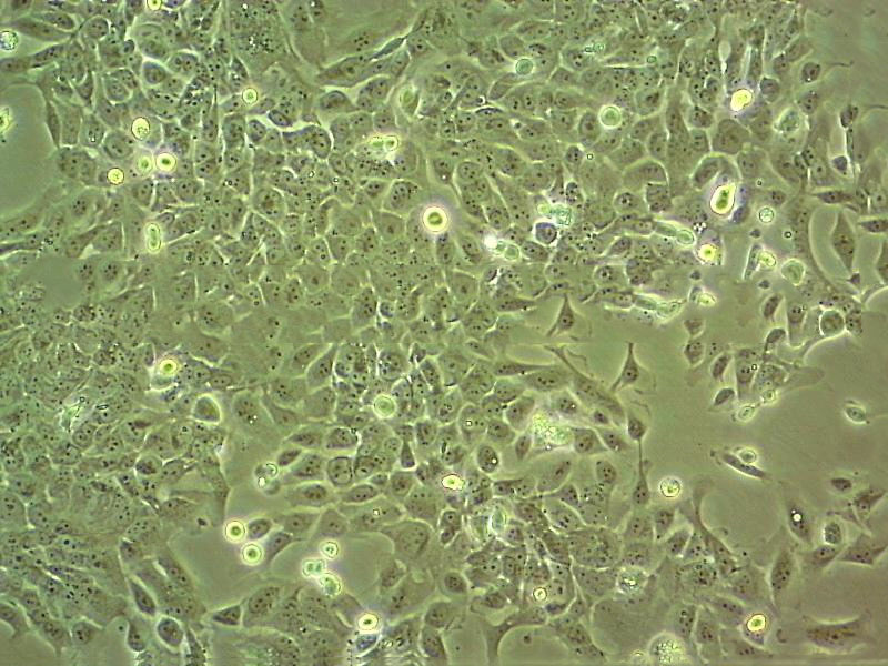 HeLa Fresh Cells|人宮頸癌細胞(送STR基因圖譜),HeLa Fresh Cells