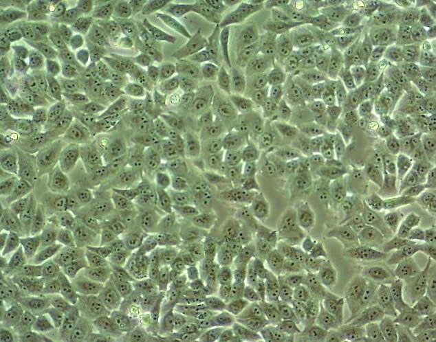 DoTc2 4510 Fresh Cells|人子宫颈癌细胞(送STR基因图谱),DoTc2 4510 Fresh Cells