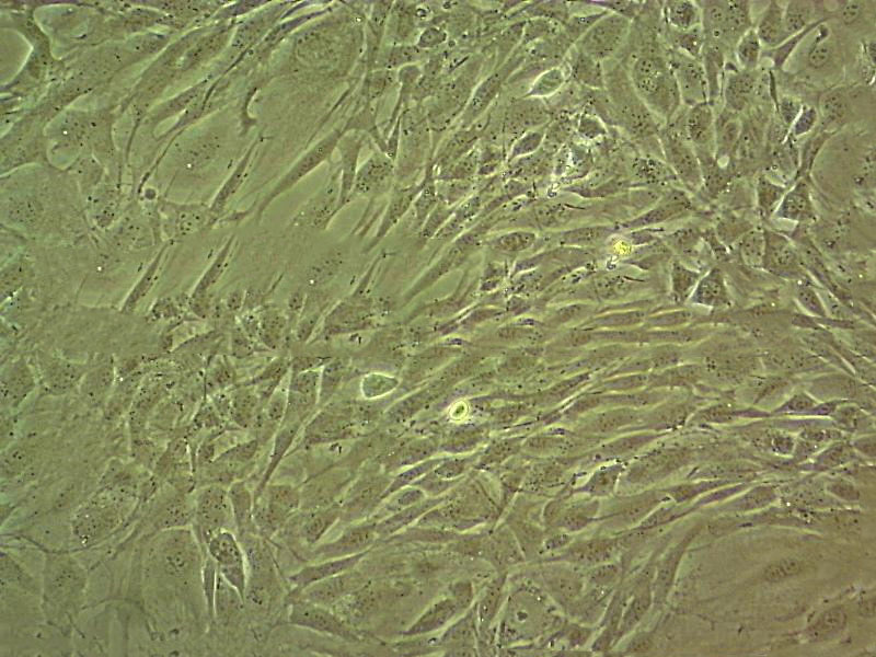 CW-2 Fresh Cells|人结肠癌细胞(送STR基因图谱),CW-2 Fresh Cells