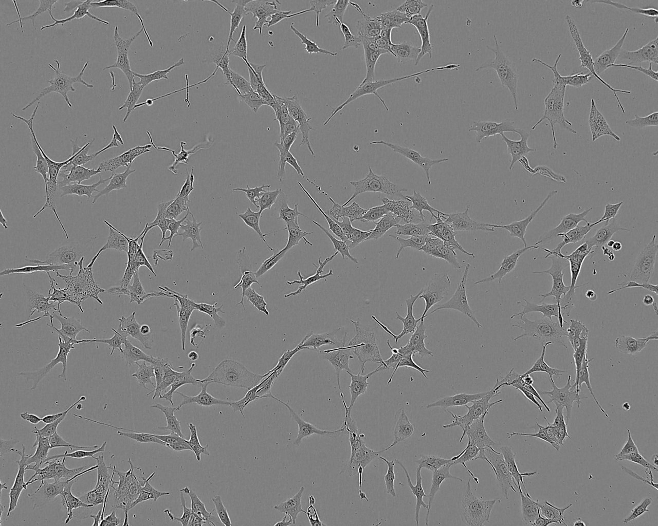VA-ES-BJ Fresh Cells|人上皮样肉瘤细胞(送STR基因图谱),VA-ES-BJ Fresh Cells