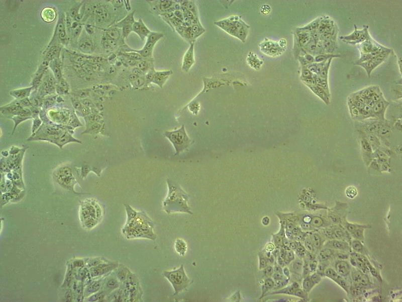 NCI-H1355 Fresh Cells|人非小细胞肺癌细胞(送STR基因图谱),NCI-H1355 Fresh Cells