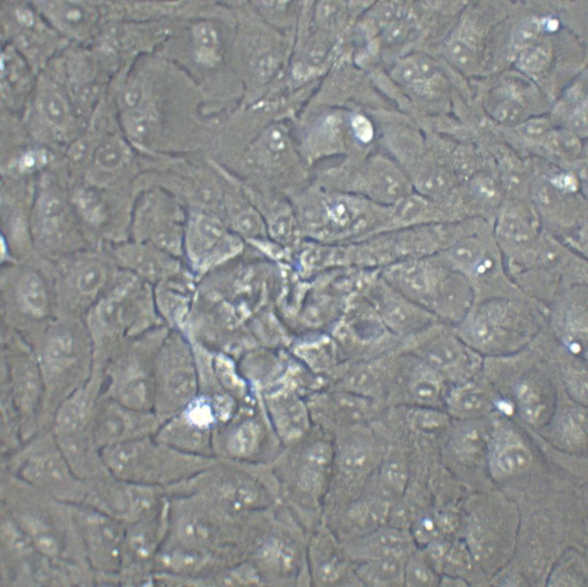 COR-L23 Fresh Cells|人肺癌细胞(送STR基因图谱),COR-L23 Fresh Cells