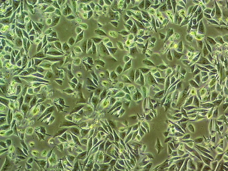 LK-2 Fresh Cells|人肺癌细胞(送STR基因图谱),LK-2 Fresh Cells