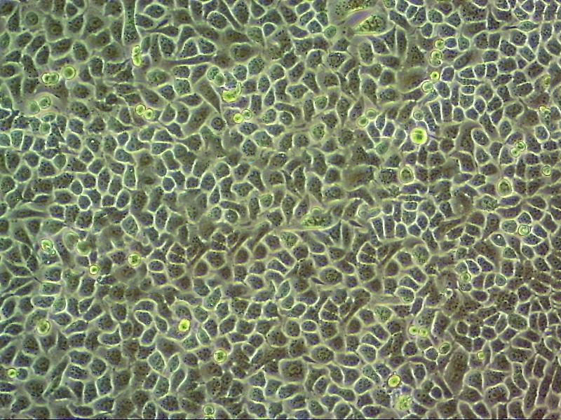 COV434 Fresh Cells|人卵巢顆粒腫瘤細(xì)胞(送STR基因圖譜),COV434 Fresh Cells